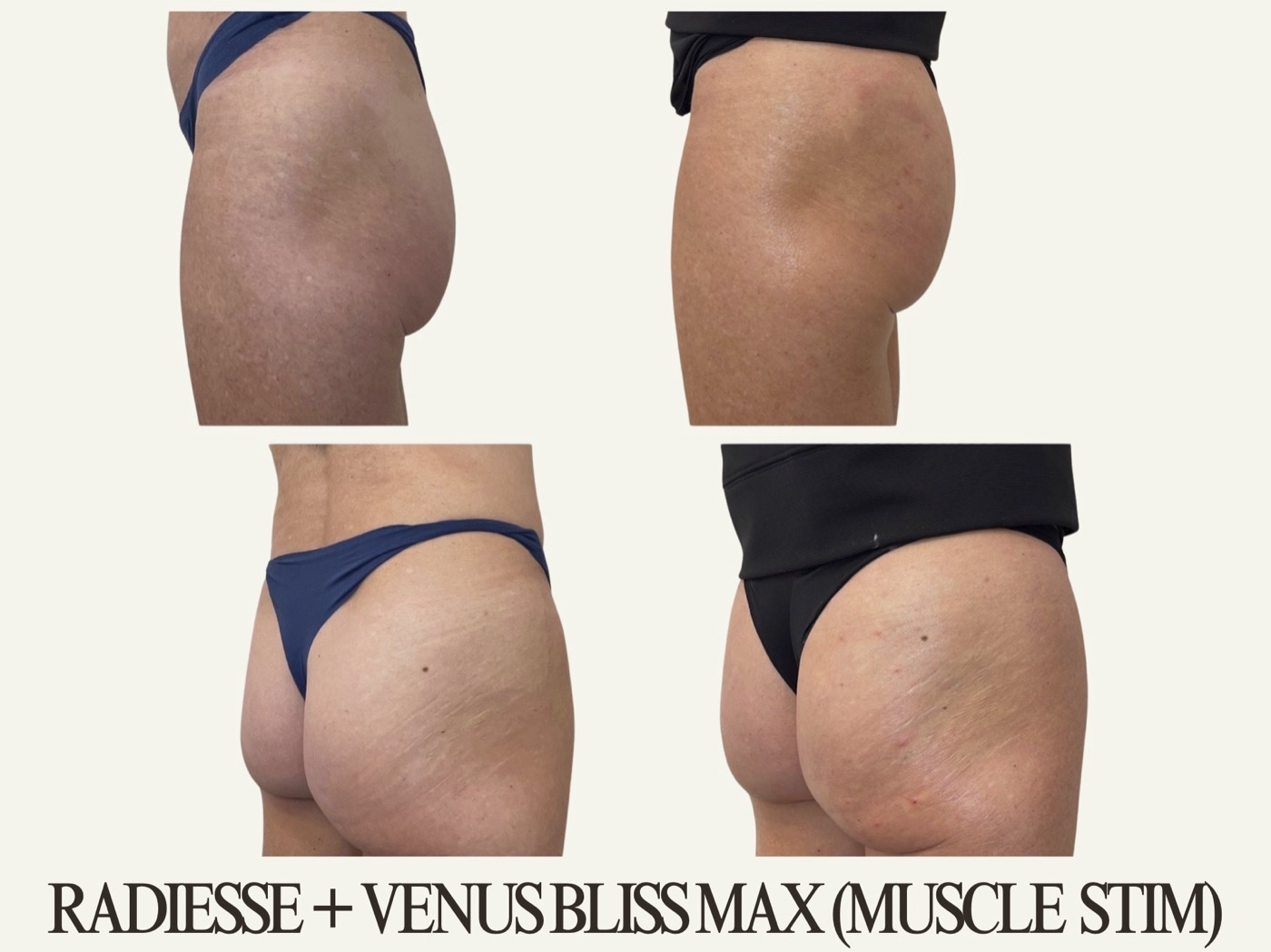 Powell Studio Booty before and after
